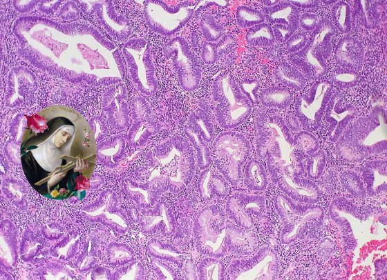 endometrium